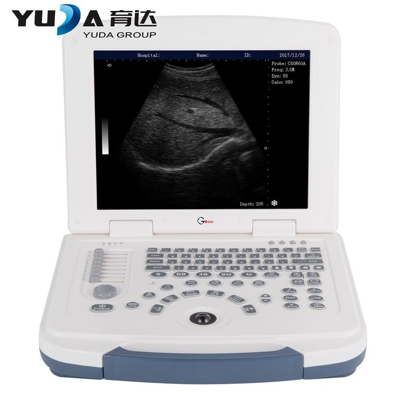 Pemindai 3D Ultrasound 3D Laptop Digital Penuh