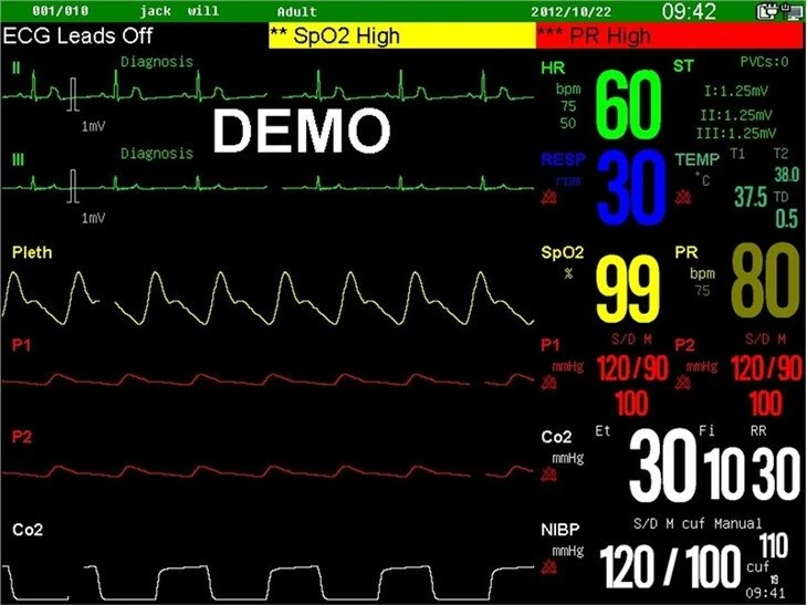Surgical Equipment Patient Monitor