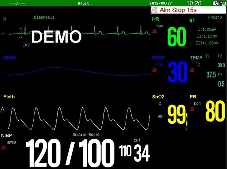 Surgical Equipment Patient Monitor