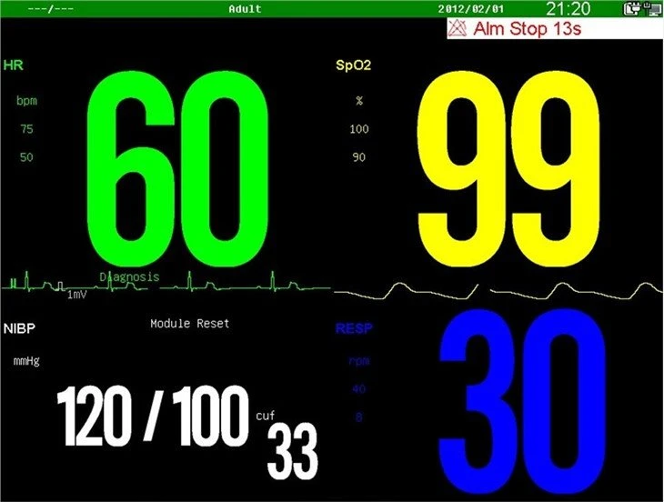 Surgical Equipment Patient Monitor